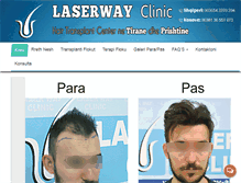 Tablet Screenshot of laserway-al.com